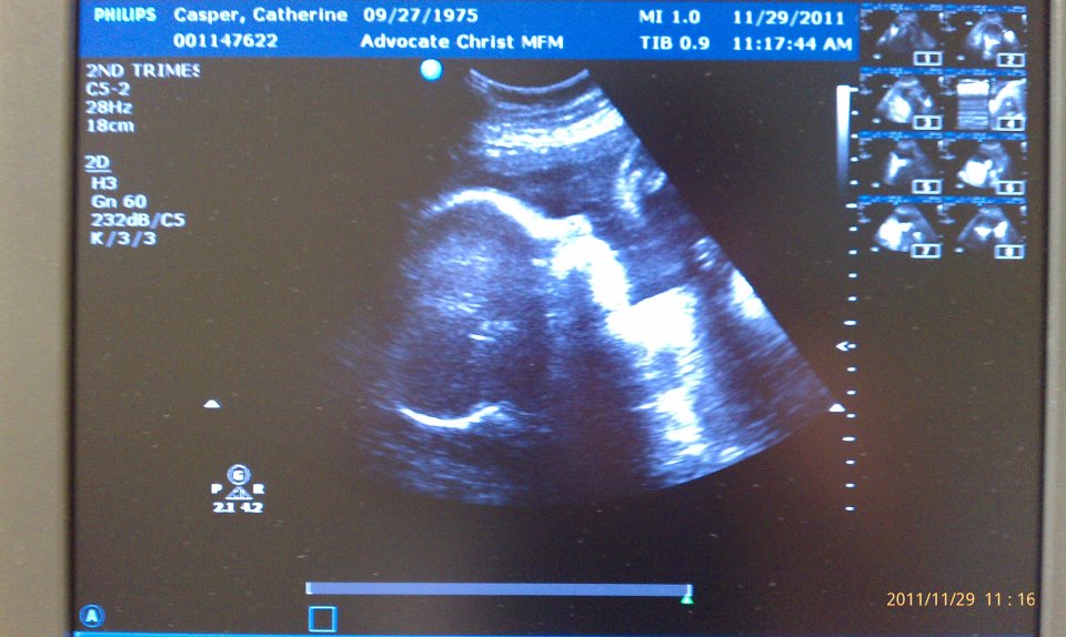 Baby Casper 11-29-11.jpg
