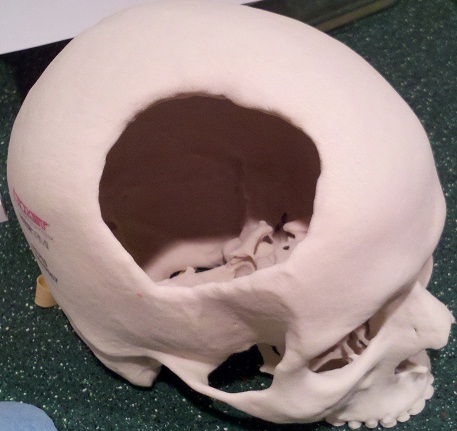 Hole.jpg